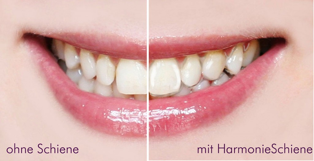 Harmonie-Schiene